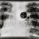 Illustration for article titled Soviet-era bootleg recordings made on discarded X-ray plates